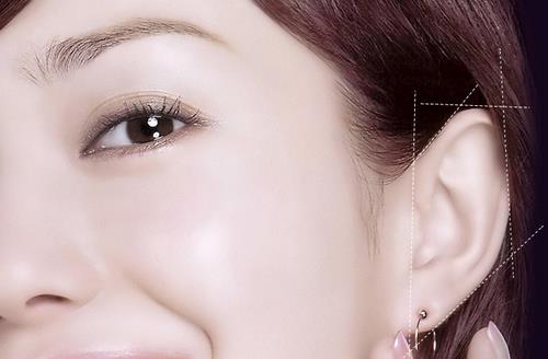 耳部整形手術(shù)注意事項(xiàng)