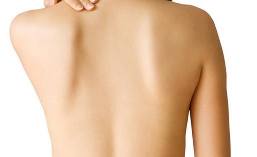 5個瘦背的方法 瘦出美背