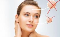 你在等痘痘熟透嗎？手癢擠痘誤大事