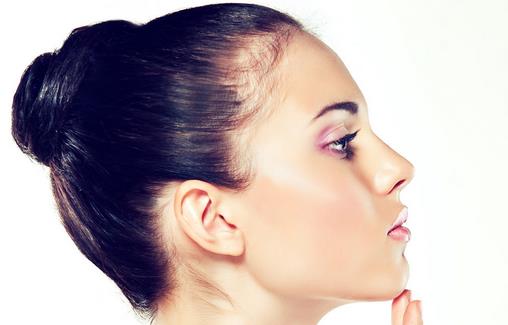 女性肌膚上火長痘飲食方法