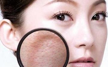 【毛孔粗大】皮膚毛孔粗大怎么辦_毛孔粗大的原因_毛孔粗大解決方法 【毛孔粗大】皮膚毛孔粗大怎么辦_毛孔粗大的原因_毛孔粗大解決方法