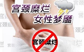 【宮頸糜爛】宮頸糜爛有哪些癥狀_宮頸糜爛如何治療_宮頸糜爛的原因 【宮頸糜爛】宮頸糜爛有哪些癥狀_宮頸糜爛如何治療_宮頸糜爛的原因