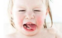 什么是蟯蟲病？蟯蟲的癥狀有哪些