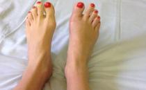 早上起來腳心疼怎么辦？