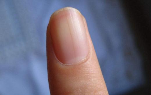 愛喝酒的男人要密切關(guān)注自己的指甲