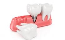 牙齒過早脫落當心是牙周炎！