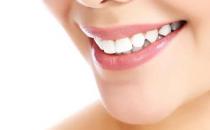 美白牙齒的小訣竅你GET了嗎？