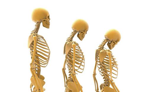 哪些方法可以預(yù)防骨質(zhì)疏松