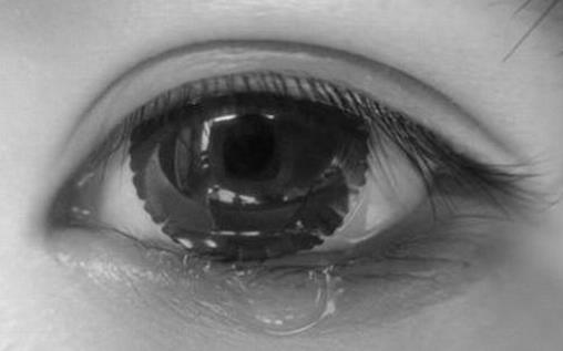 眼睛瘙癢應(yīng)該怎么辦