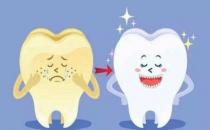 目前最火的牙齒美白手段 牙醫才懂的牙齒美白利與弊