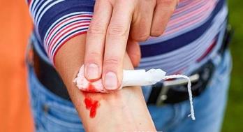 這12個野外急救措施 關鍵時刻真能救命