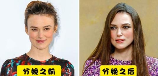 女性在分娩之后會經歷7個不常見的身體變化