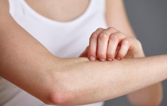 春季易引發的皮膚病 幾種方法助你輕松應對