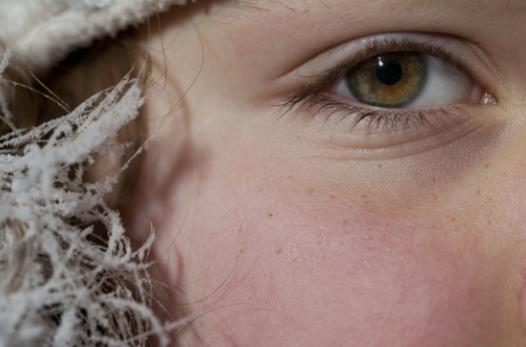 面部色斑知多少 導致色斑的習慣大揭秘