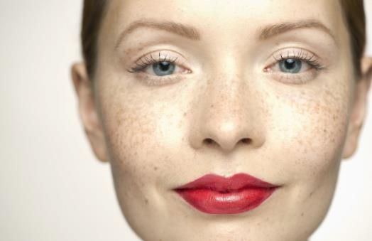 面部色斑知多少 導致色斑的習慣大揭秘