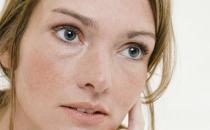 面部色斑知多少 導致色斑的習慣大揭秘