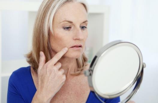 嘴角四周長痘 內因外顯 這些方法可有效去除嘴角長痘