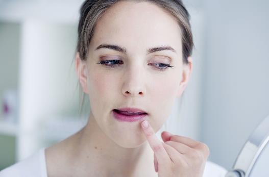 嘴角四周長痘 內因外顯 這些方法可有效去除嘴角長痘