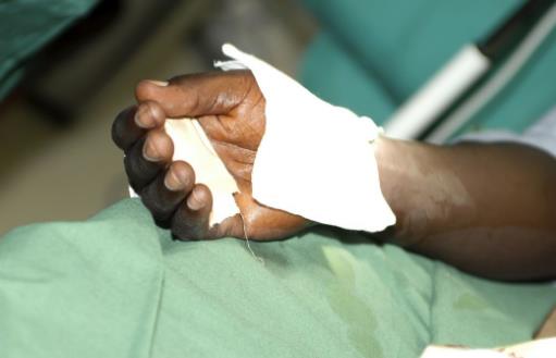 生活中的急救知識 避免踏入這些誤區