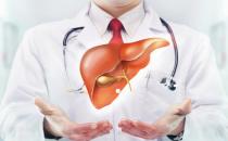 判斷自己肝臟有問題 肝臟不好飲食調(diào)理效果好