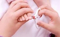 給寶寶剪指甲 寶爸寶媽多留心細節的事情