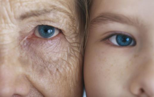 皮膚衰老顏齡大增的臉部細節 隨著年齡增長皮脂降低