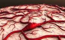 腦出血發生前兆的癥狀 保持心情舒暢預防腦出血