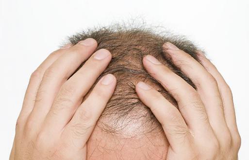 身體早衰現象你都知道嗎