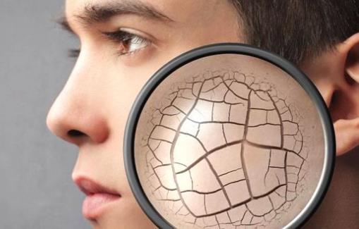 春季皮膚干燥食療方 做好皮膚保濕雙管齊下