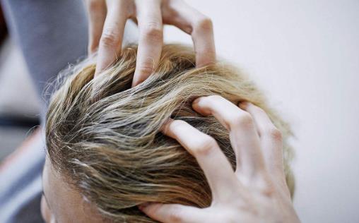 頭屑很嚴重滿頭都是怎么辦?4個好方法幫你來應對