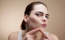 別在硬擠黑頭粉刺 教你即刻恢復干凈漂亮鼻頭