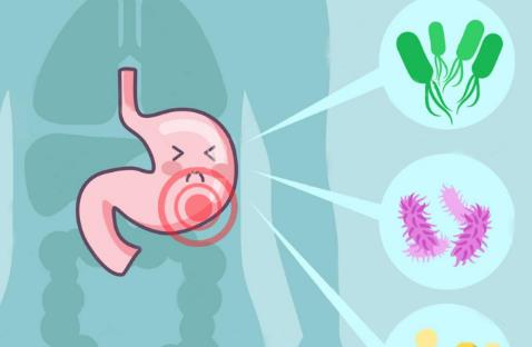 體內有幽門螺桿菌,身體往往有五個標志,占的越多,胃癌