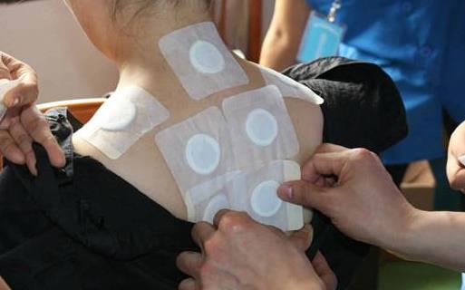 冬病夏治敷貼三伏貼 科學合理敷貼三伏貼