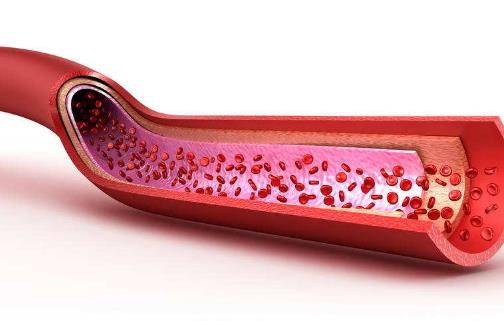 血管是人的生命的通道 養護血管的飲食調理