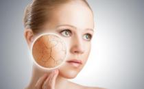 保養皮膚要適度過度清潔危害大 錯誤護膚方式很可怕