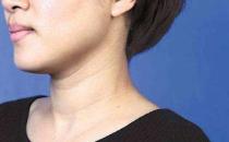 不讓頸紋出賣年齡 鍛煉頸部肌肉讓自己更年輕