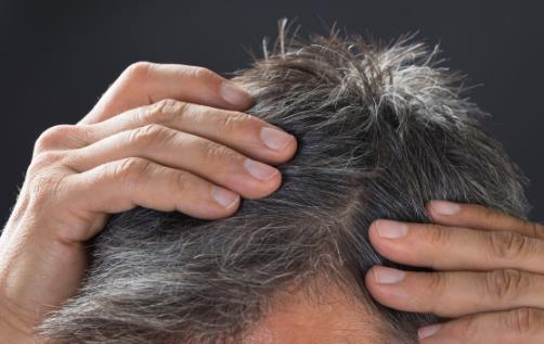 導致頭發變白的壞習慣 小習慣就能擁有一頭烏黑秀發