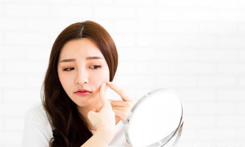 預防青春痘的4個方法