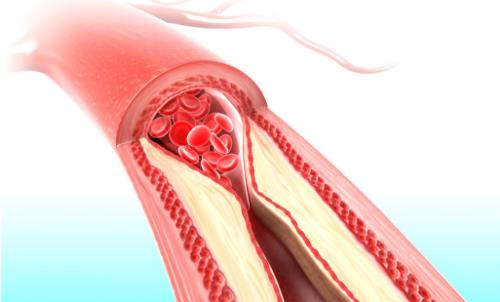 如何減少飲食中的脂肪量?這些方法你學會了嗎?