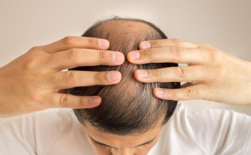 頭發(fā)少要怎么保養(yǎng)?四個(gè)問(wèn)題要注意
