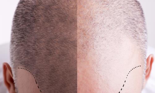 頭發(fā)少要怎么保養(yǎng)?四個(gè)問(wèn)題要注意