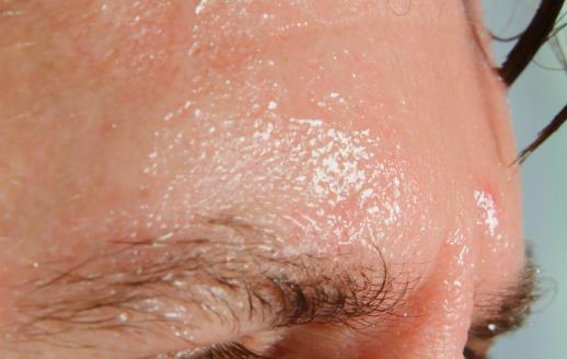 出汗并非都是健康 不正常的出汗有可能是疾病的癥狀