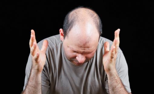 脫發或是疾病引起 防止脫發的最佳六大方法