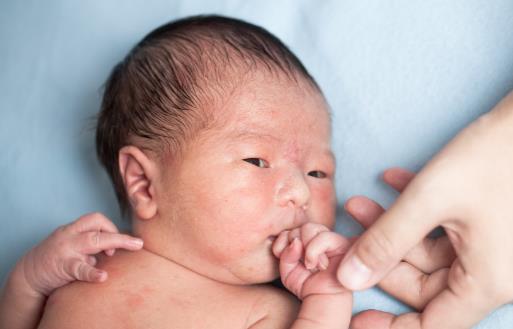 產后痔瘡與這些因素有關 產后痔瘡食療方法推薦