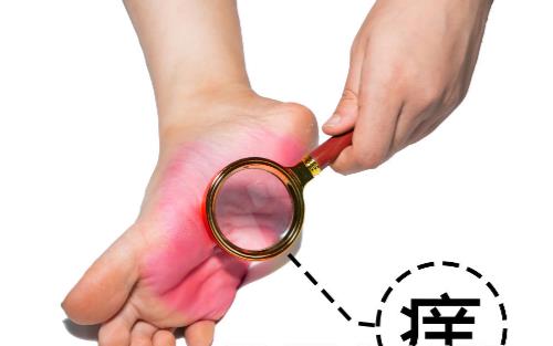 有腳氣的人,經常用鹽水泡腳就能消滅真菌嗎?它沒有這個