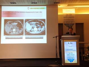 濟南腫瘤醫院選擇廣州復大腫瘤醫院：冷凍需要新理念