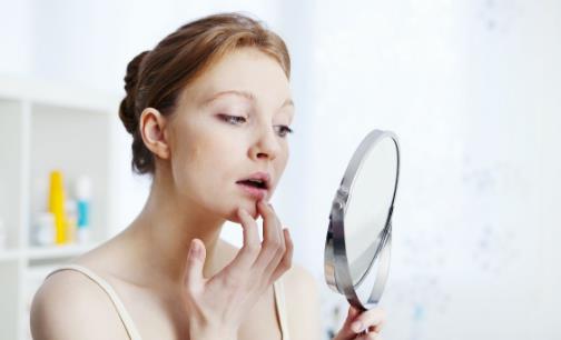 下巴長(zhǎng)痘是什么原因造成的 天然祛痘祛印的方法分享