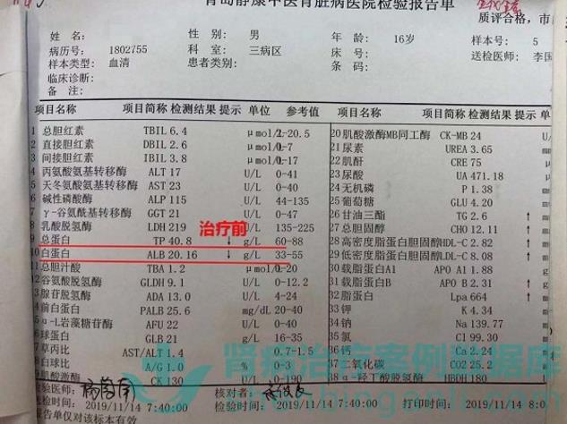 腎病綜合征小患者青島靜康中醫(yī)腎病醫(yī)院治療后病情改善