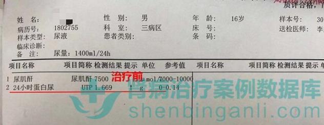 腎病綜合征小患者青島靜康中醫(yī)腎病醫(yī)院治療后病情改善