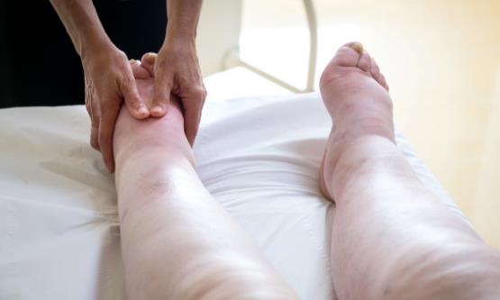 總是吃太咸的食物易引發水腫 吃得太咸還會引發什么疾病